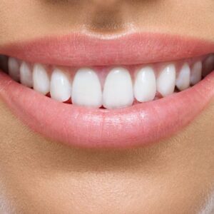 smile-anatomy-min-925x425
